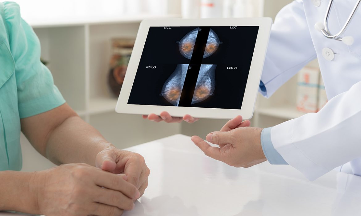 The best 3D mammogram in Sparta, NJ